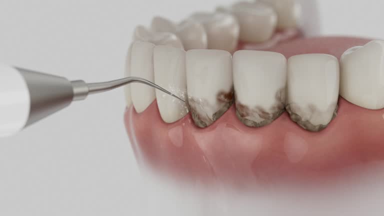 Reliable Dental Implants contractor in West Covina, CA by Smile Center Dentistry